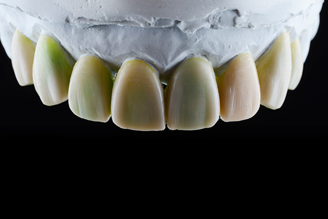 術前診断・その他